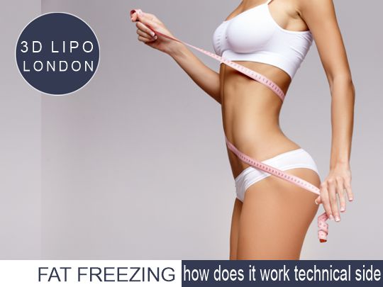 Fat freezing technical side